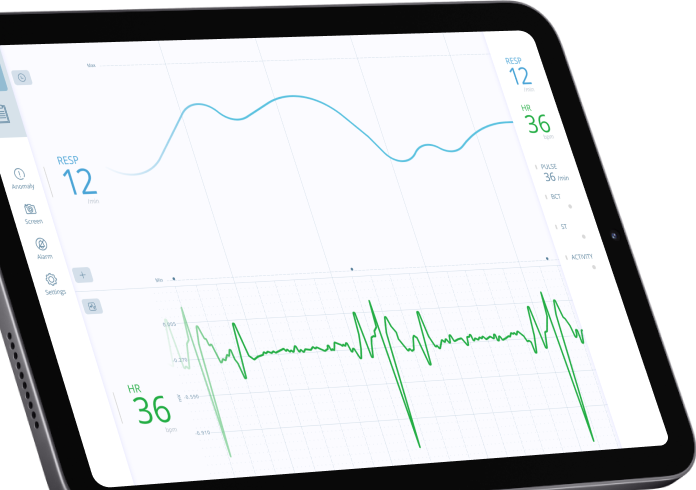 Medical monitor displaying vital signs